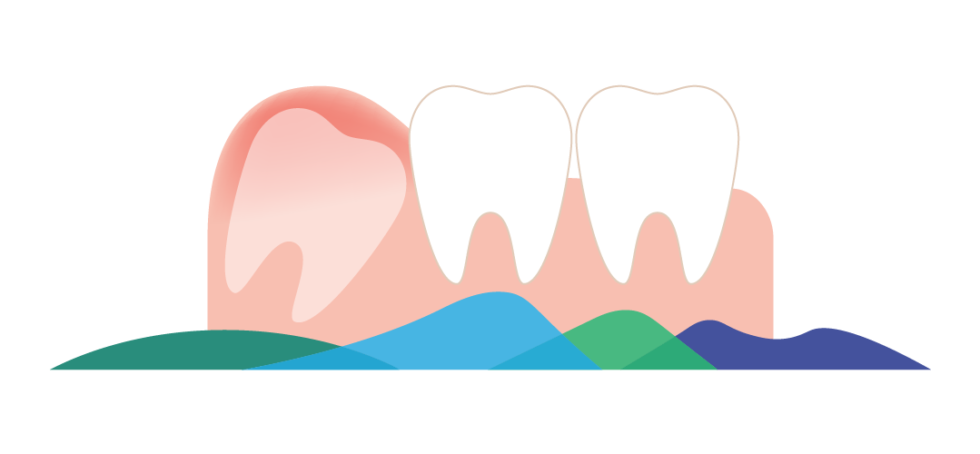 oral-surgery-resource-guide-boise-oral-surgery-dental-implant-center