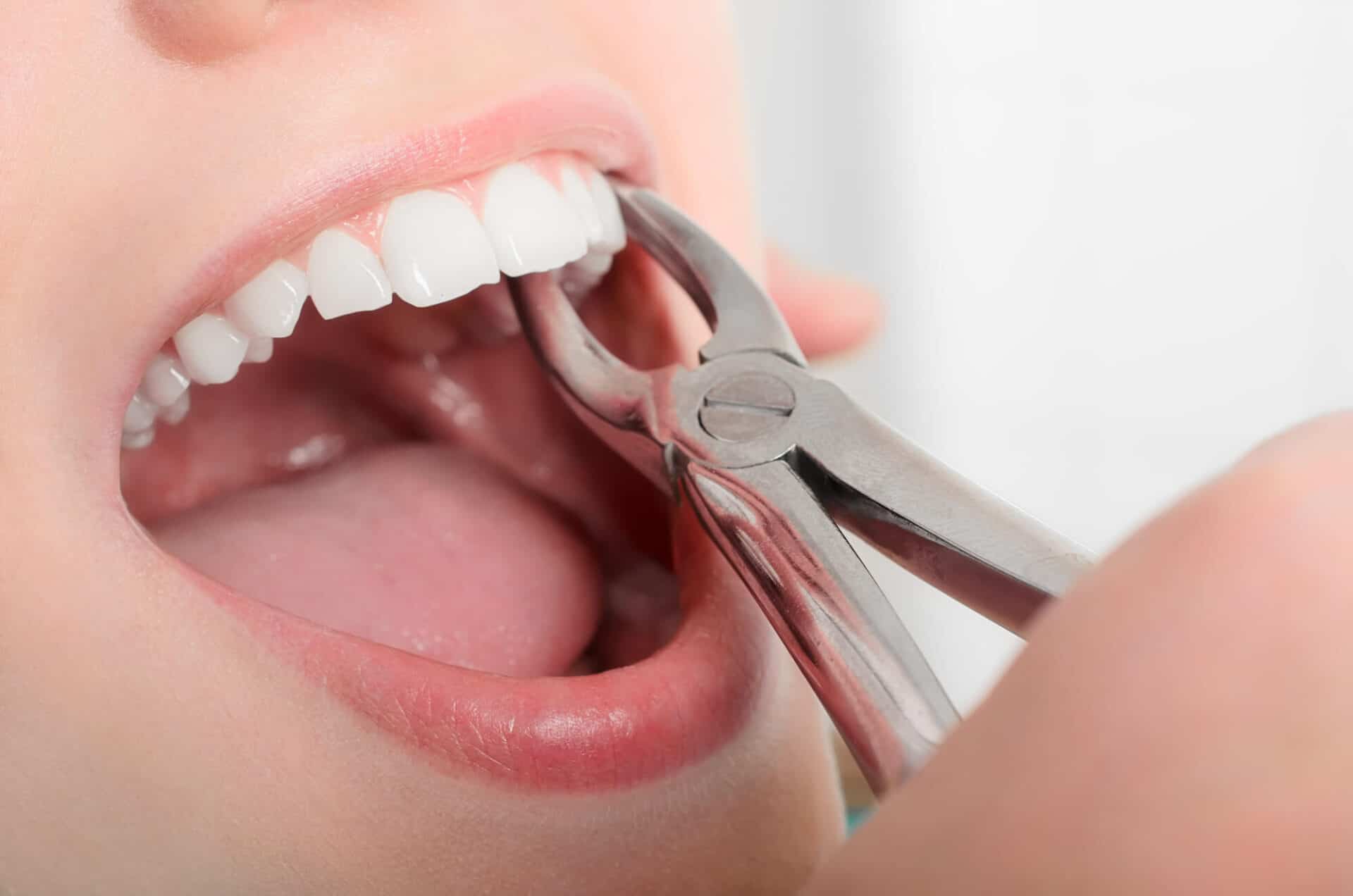 is a tooth extraction painful