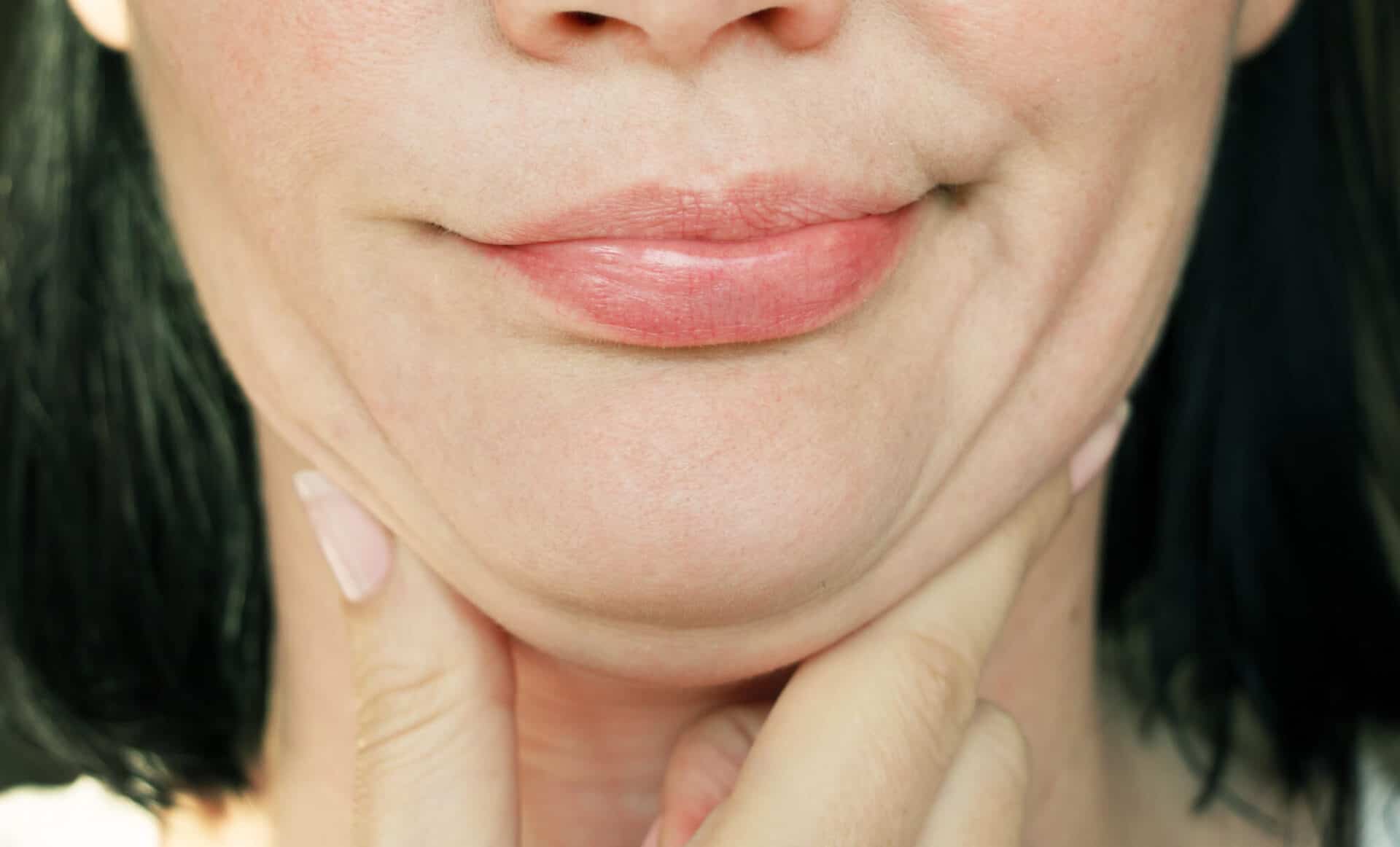 jaw correction surgery